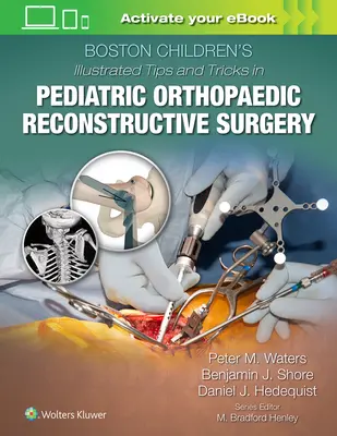 Boston Children's Illustrated Tips and Tricks in Pediatric Orthopaedic Reconstructive Surgery (Bostoni Gyermekek illusztrált tippek és trükkök a gyermekortopédiai helyreállító sebészetben) - Boston Children's Illustrated Tips and Tricks in Pediatric Orthopaedic Reconstructive Surgery