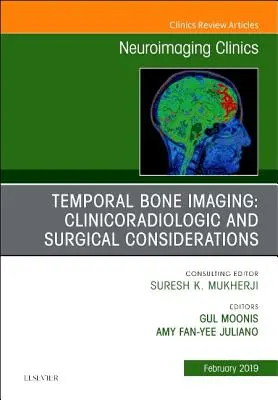 A halántékcsontok képalkotása: Clinicoradiologic and Surgical Considerations, an Issue of Neuroimaging Clinics of North America, 29. - Temporal Bone Imaging: Clinicoradiologic and Surgical Considerations, an Issue of Neuroimaging Clinics of North America, 29