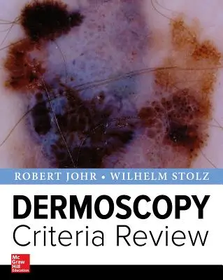 A dermoszkópia kritériumainak felülvizsgálata - Dermoscopy Criteria Review