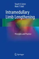 Intramedulláris végtaghosszabbítás: Elvek és gyakorlat - Intramedullary Limb Lengthening: Principles and Practice