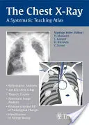 A mellkas röntgenfelvétel: A Systematic Teaching Atlas - The Chest X-Ray: A Systematic Teaching Atlas