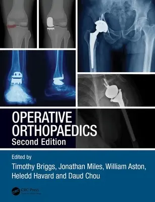 Operatív ortopédia - Operative Orthopaedics