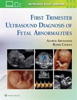 A magzati rendellenességek első trimeszteri ultrahangos diagnózisa - First Trimester Ultrasound Diagnosis of Fetal Abnormalities