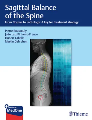 A gerinc ságittális egyensúlya: A normálistól a patológiáig: A kezelési stratégia kulcsa - Sagittal Balance of the Spine: From Normal to Pathology: A Key for Treatment Strategy