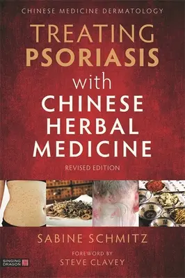 A pikkelysömör kezelése kínai gyógynövényekkel (Felülvizsgált kiadás): Gyakorlati kézikönyv - Treating Psoriasis with Chinese Herbal Medicine (Revised Edition): A Practical Handbook