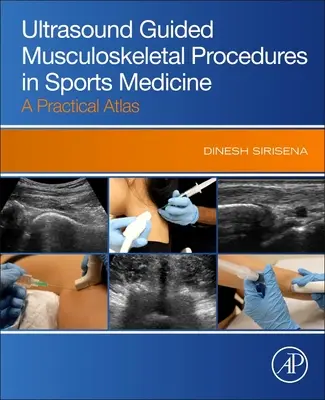 Ultrahangvezérelt mozgásszervi eljárások a sportorvoslásban - Gyakorlati atlasz - Ultrasound Guided Musculoskeletal Procedures in Sports Medicine - A Practical Atlas