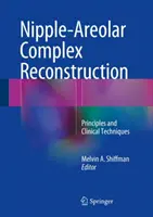 A bimbó-oroszlán komplexum rekonstrukciója: Alapelvek és klinikai technikák - Nipple-Areolar Complex Reconstruction: Principles and Clinical Techniques