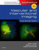 Érrendszeri és intervenciós képalkotás: Case Review Series - Vascular and Interventional Imaging: Case Review Series