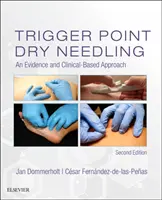 Trigger Point Dry Needling: A bizonyítékokon és a klinikai tapasztalatokon alapuló megközelítés - Trigger Point Dry Needling: An Evidence and Clinical-Based Approach