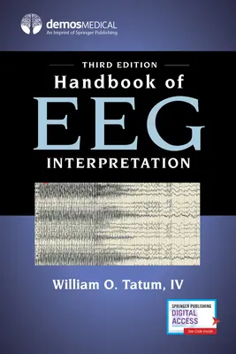 Az Eeg-értelmezés kézikönyve - Handbook of Eeg Interpretation