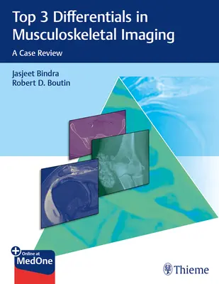 Top 3 differenciáldiagnózis a mozgásszervi képalkotásban: A Case Review - Top 3 Differentials in Musculoskeletal Imaging: A Case Review