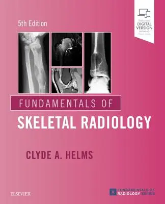 A csontvázradiológia alapjai - Fundamentals of Skeletal Radiology