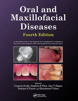 Száj- és állcsont- és állkapocsbetegségek, negyedik kiadás - Oral and Maxillofacial Diseases, Fourth Edition