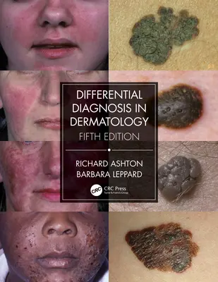 Differenciáldiagnózis a bőrgyógyászatban - Differential Diagnosis in Dermatology