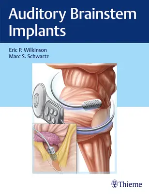 Agytörzsi implantátumok - Auditory Brainstem Implants