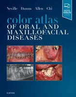 A száj- és állkapocsbetegségek színes atlasza - Color Atlas of Oral and Maxillofacial Diseases