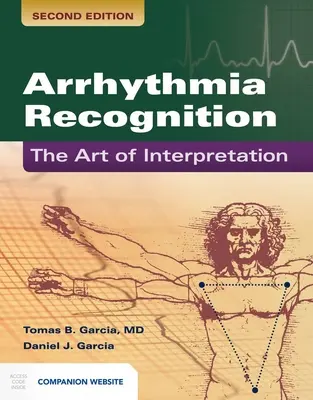 Az aritmia felismerése: Az értelmezés művészete: Az értelmezés művészete - Arrhythmia Recognition: The Art of Interpretation: The Art of Interpretation