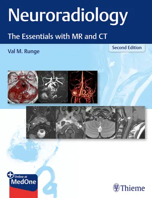 Neuroradiológia: CT-vel - Neuroradiology: The Essentials with MR and CT