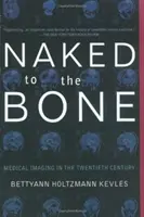 Meztelenül a csontig: Orvosi képalkotás a huszadik században - Naked to the Bone: Medical Imaging in the Twentieth Century