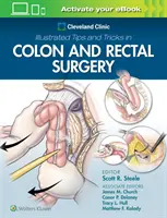 A Cleveland Klinika illusztrált tippjei és trükkjei a vastagbél- és végbélsebészetben - Cleveland Clinic Illustrated Tips and Tricks in Colon and Rectal Surgery