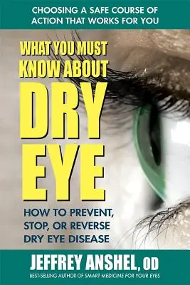 Amit a szemszárazságról tudni kell: Hogyan előzze meg, állítsa meg vagy fordítsa vissza a szemszárazság betegséget? - What You Must Know about Dry Eye: How to Prevent, Stop, or Reverse Dry Eye Disease