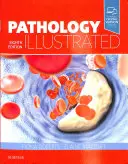 Pathology Illustrated