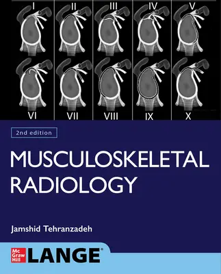 Alapvető mozgásszervi képalkotás, második kiadás - Basic Musculoskeletal Imaging, Second Edition