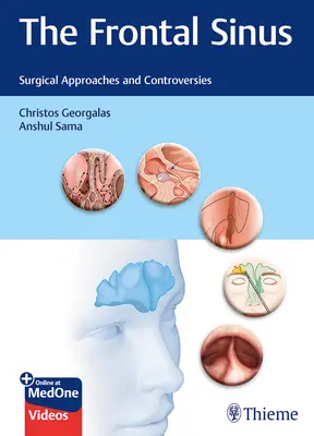 A homloküreg: Sebészeti megközelítések és viták - The Frontal Sinus: Surgical Approaches and Controversies