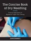 A száraz tűzés tömör könyve - A gyakorlati szakember útmutatója a myofasciális triggerpontok alkalmazásához - Concise Book of Dry Needling - A Practitioner's Guide to Myofascial Trigger Point Applications