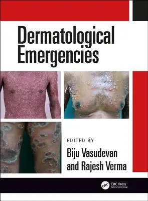 Bőrgyógyászati vészhelyzetek - Dermatological Emergencies