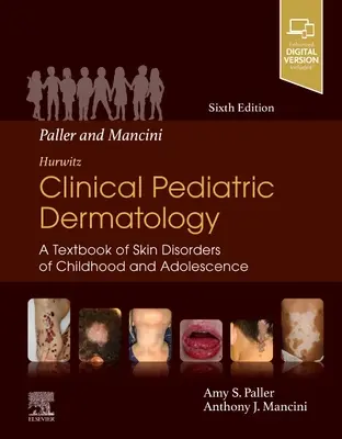 Paller és Mancini - Hurwitz Klinikai gyermekbőrgyógyászat: A gyermek- és serdülőkori bőrbetegségek tankönyve - Paller and Mancini - Hurwitz Clinical Pediatric Dermatology: A Textbook of Skin Disorders of Childhood & Adolescence