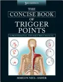 Concise Book of Trigger Points