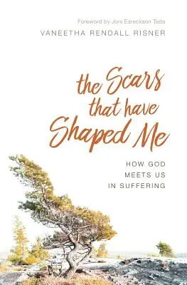 A sebhelyek, amelyek formáltak engem: Hogyan találkozik velünk Isten a szenvedésben - The Scars That Have Shaped Me: How God Meets Us in Suffering