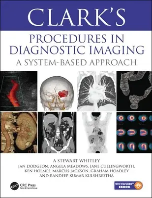 Clark eljárásai a képalkotó diagnosztikában - Rendszeralapú megközelítés - Clark's Procedures in Diagnostic Imaging - A System-Based Approach
