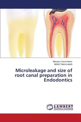 Mikroszivárgás és a gyökércsatorna-előkészítés mérete az endodontia területén - Microleakage and size of root canal preparation in Endodontics