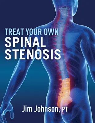 Kezelje saját gerincferdülését - Treat Your Own Spinal Stenosis