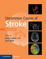 A stroke nem gyakori okai - Uncommon Causes of Stroke