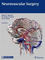 Neurovaszkuláris sebészet - Neurovascular Surgery