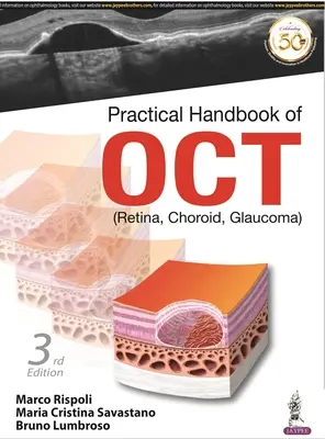 Az OCT gyakorlati kézikönyve - (Retina, Choroid, Glaukóma) - Practical Handbook of OCT - (Retina, Choroid, Glaucoma)