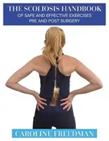 Scoliosis Handbook of Safe and Effective Exercises Pre and Post Surgery (A műtét előtti és utáni biztonságos és hatékony gyakorlatok kézikönyve) - Scoliosis Handbook of Safe and Effective Exercises Pre and Post Surgery