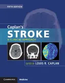 Caplan agyvérzése: A Clinical Approach - Caplan's Stroke: A Clinical Approach