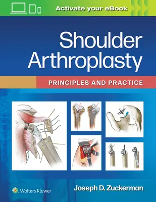 Vállízületi műtét: Alapelvek és gyakorlat - Shoulder Arthroplasty: Principles and Practice