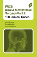 Frcs (száj- és állcsont-, állcsont- és állcsontsebészet) 2. rész: 100 klinikai eset - Frcs (Oral & Maxillofacial Surgery) Part 2: 100 Clinical Cases