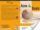 ACNE és SZARNOK - ACNE and SCARS