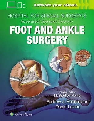 Hospital for Special Surgery's Illustrated Tips and Tricks in Foot and Ankle Surgery (A speciális sebészeti kórház illusztrált tippjei és trükkjei a láb- és bokaműtétekhez) - Hospital for Special Surgery's Illustrated Tips and Tricks in Foot and Ankle Surgery