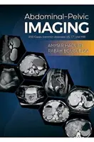 Hasi-kismedencei képalkotás - 200 eset (gyakori betegségek): US, CT és MRI - Abdominal-Pelvic Imaging - 200 Cases (Common Diseases): US, CT and MRI