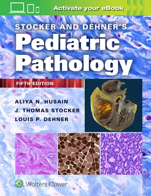 Stocker és Dehner gyermekpatológiája - Stocker and Dehner's Pediatric Pathology