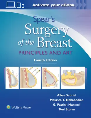 Spear's Surgery of the Breast: Elvek és művészet - Spear's Surgery of the Breast: Principles and Art