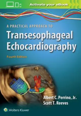 A transzezofageális echokardiográfia gyakorlati megközelítése - A Practical Approach to Transesophageal Echocardiography