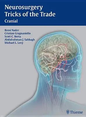 Idegsebészeti trükkök - koponya: Cranial - Neurosurgery Tricks of the Trade - Cranial: Cranial